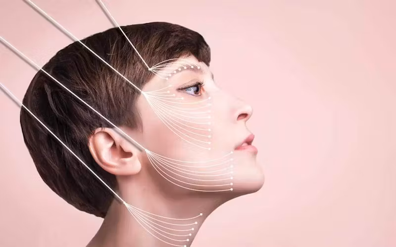 Face lifting
